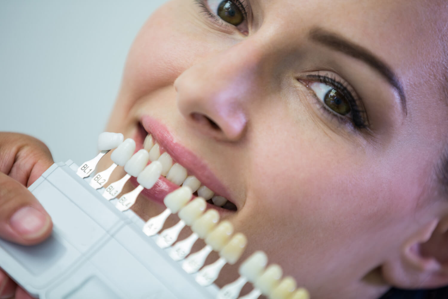 Paciente da Clínica Só Riso em Patos de Minas compara a cor natural dos dentes com guia de tons para lentes de contato dental sem desgaste.
